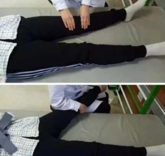 膝過伸不煩惱，康復訓練有妙招